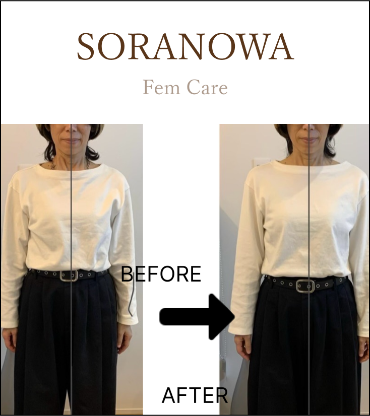 フェムケア矯正の施術前後の写真