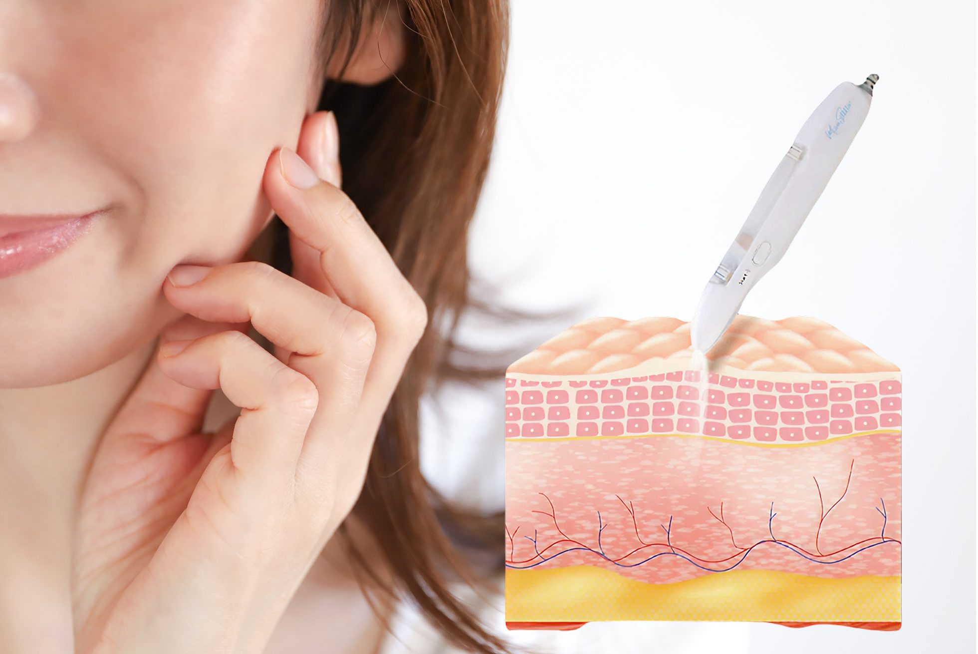 ペネトレーションシステムのしくみ・肌断面図